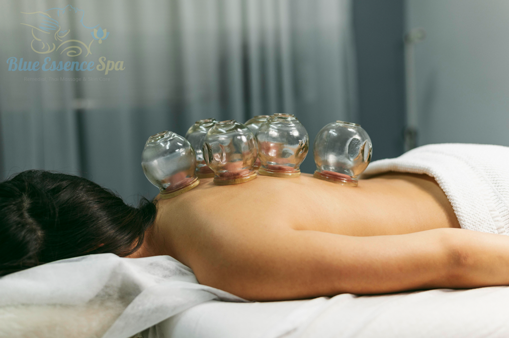 cupping-1024x681